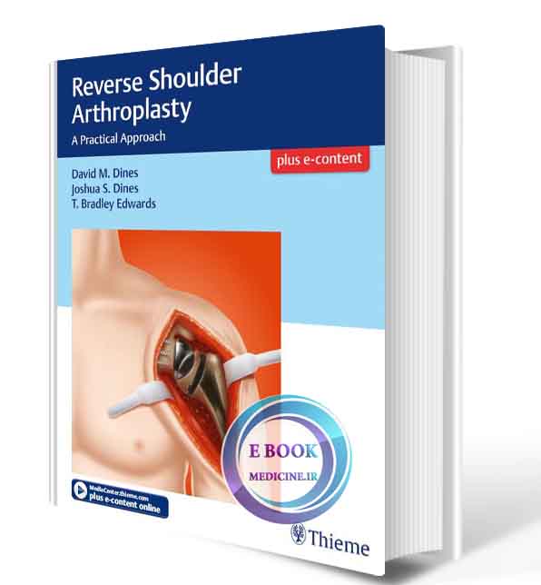 دانلود کتابReverse Shoulder Arthroplasty A Practical Approach 2018 (ORIGINAL PDF)